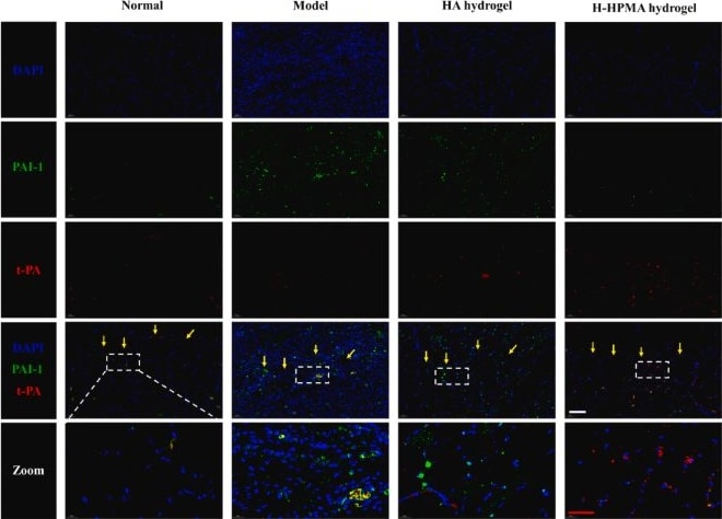 Serpin E1/PAI-1 Antibody - BSA Free