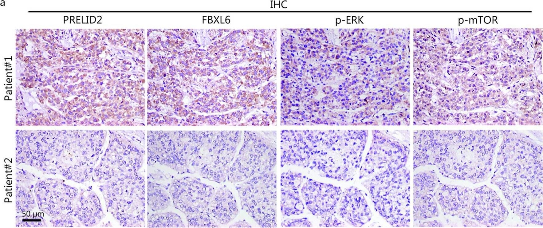 PRELID2 Antibody - BSA Free