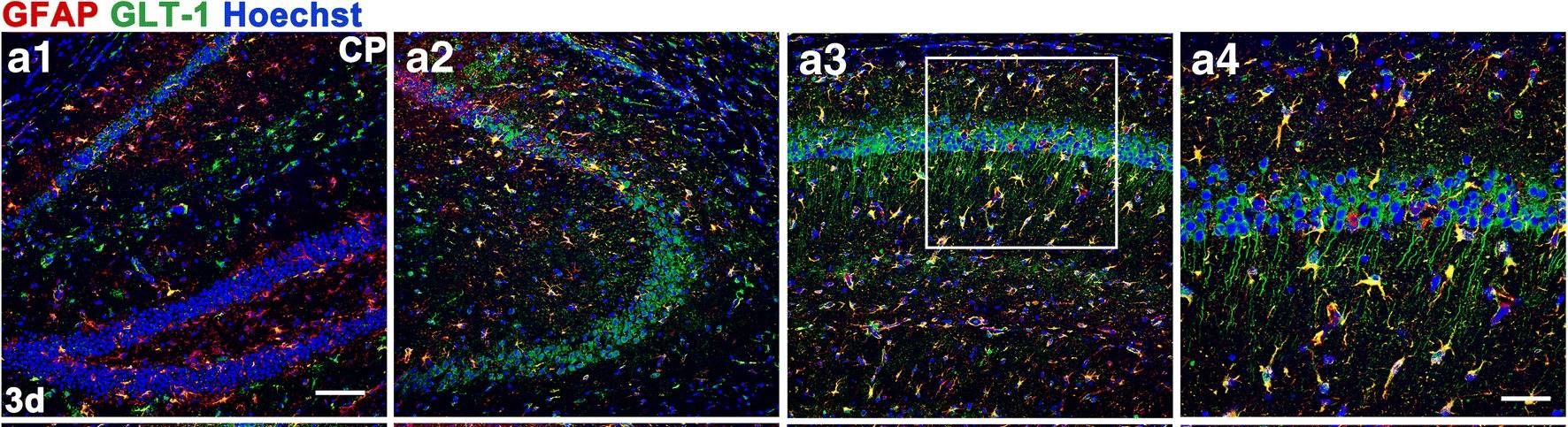 EAAT2/GLT1 Antibody
