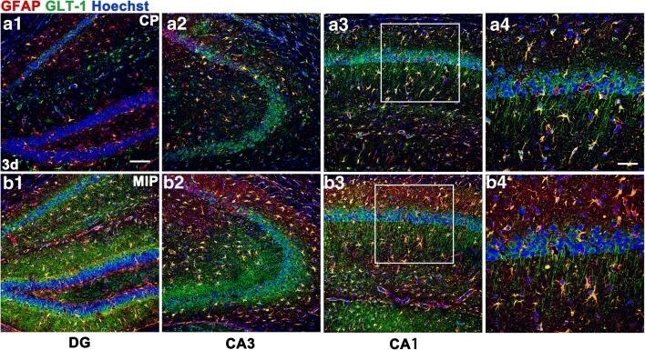 EAAT2/GLT1 Antibody