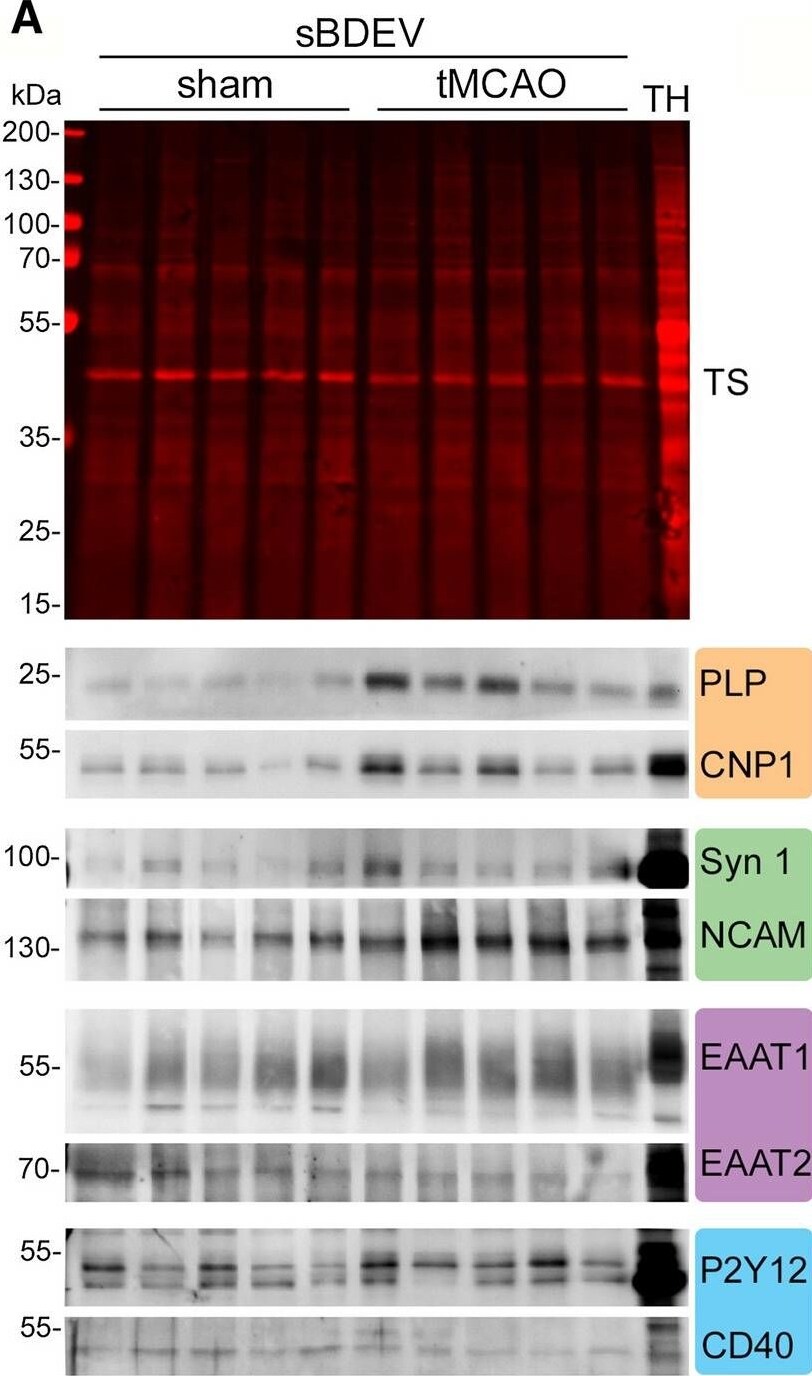 EAAT2/GLT1 Antibody