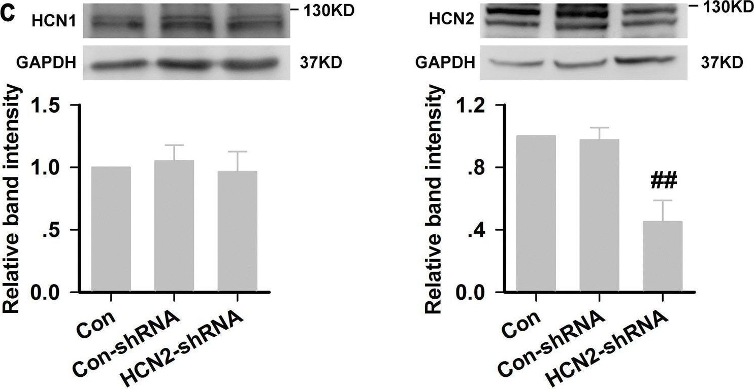 HCN1 Antibody