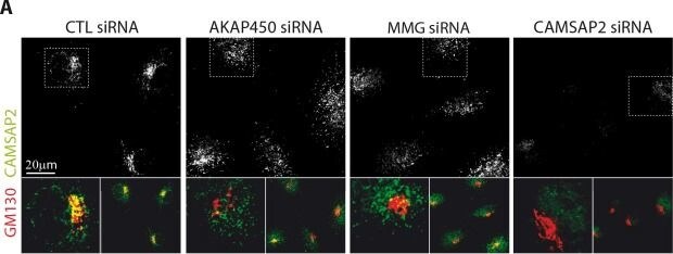 CAMSAP1L1 Antibody