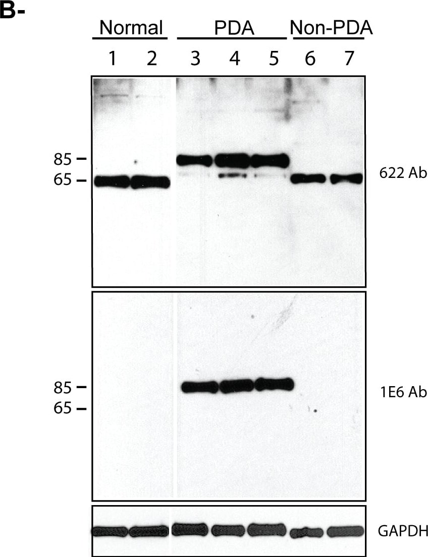 Palladin Antibody (1E6)