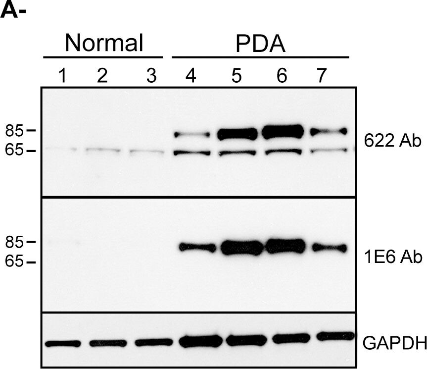 Palladin Antibody (1E6)