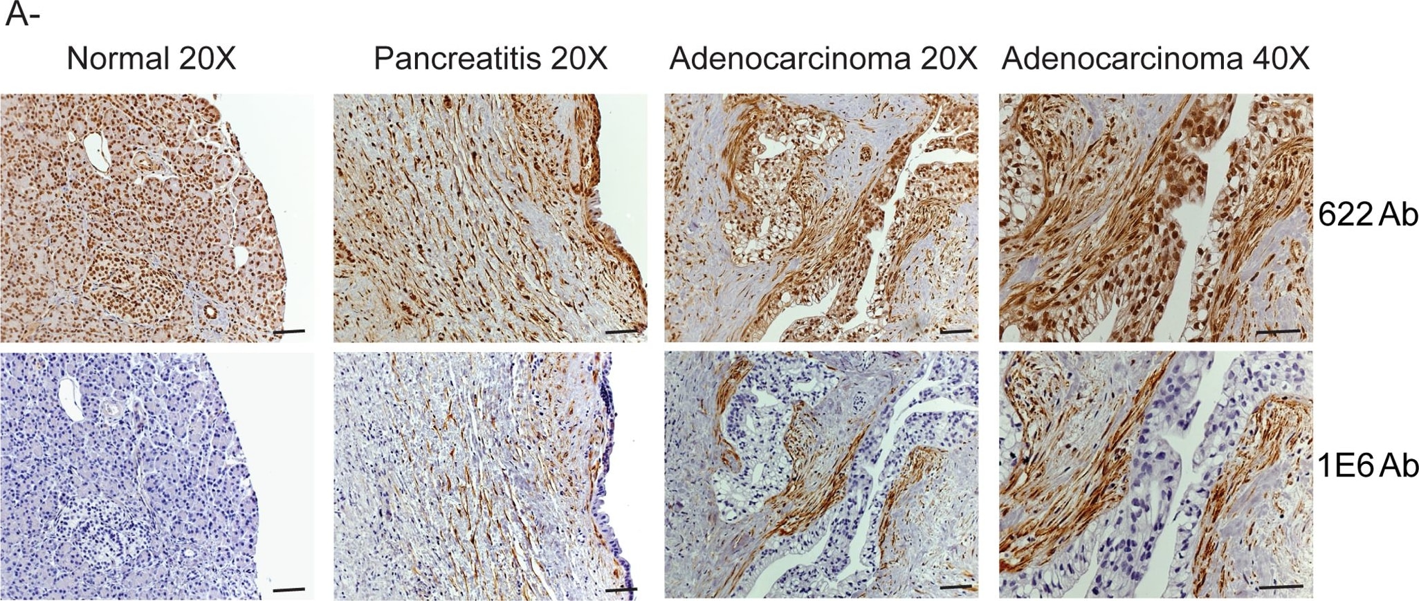 Palladin Antibody (1E6)