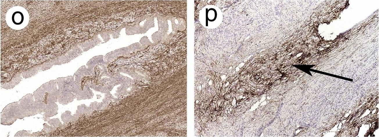 Collagen IV Antibody