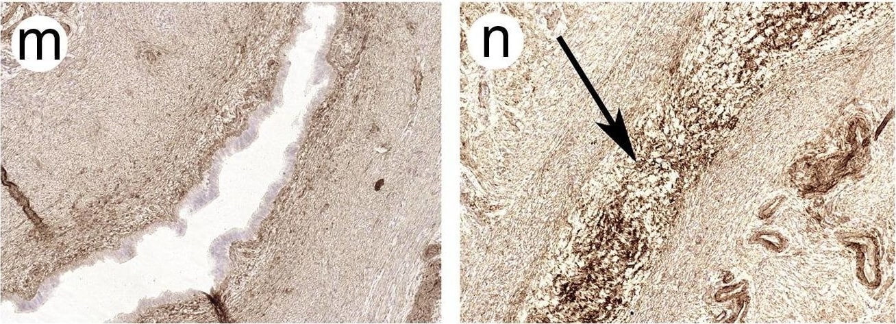 Collagen IV Antibody