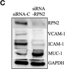 VCAM-1/CD106 Antibody (1.G11B1)