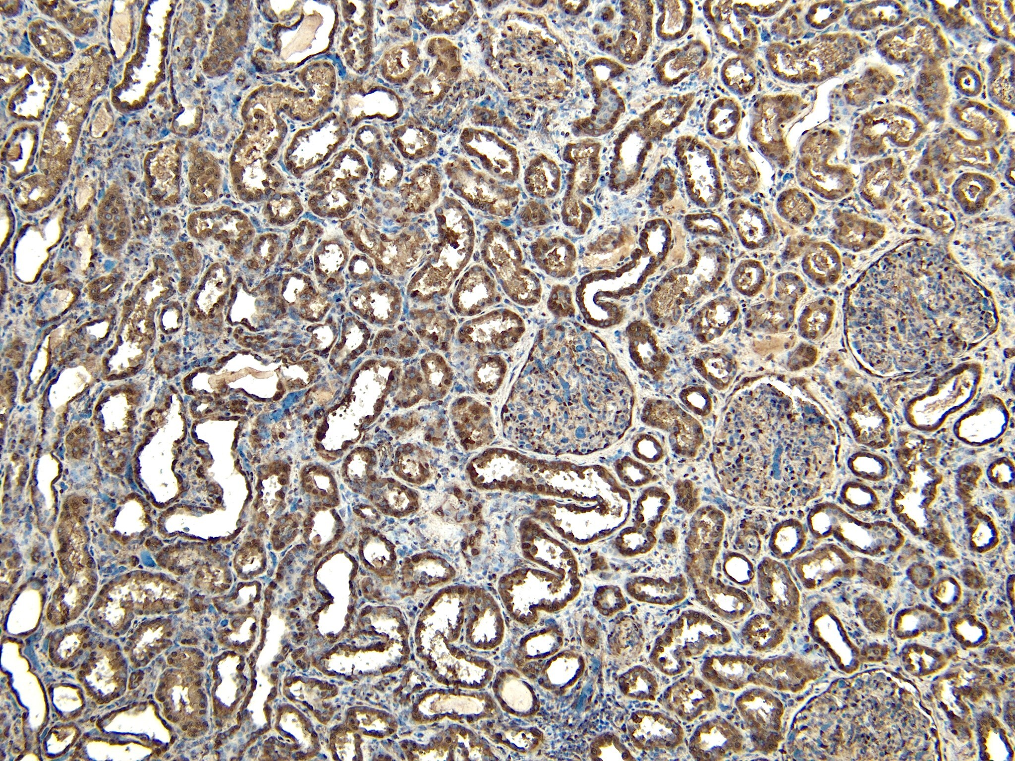 EWSR1 Antibody