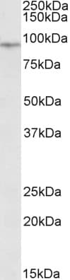 EWSR1 Antibody