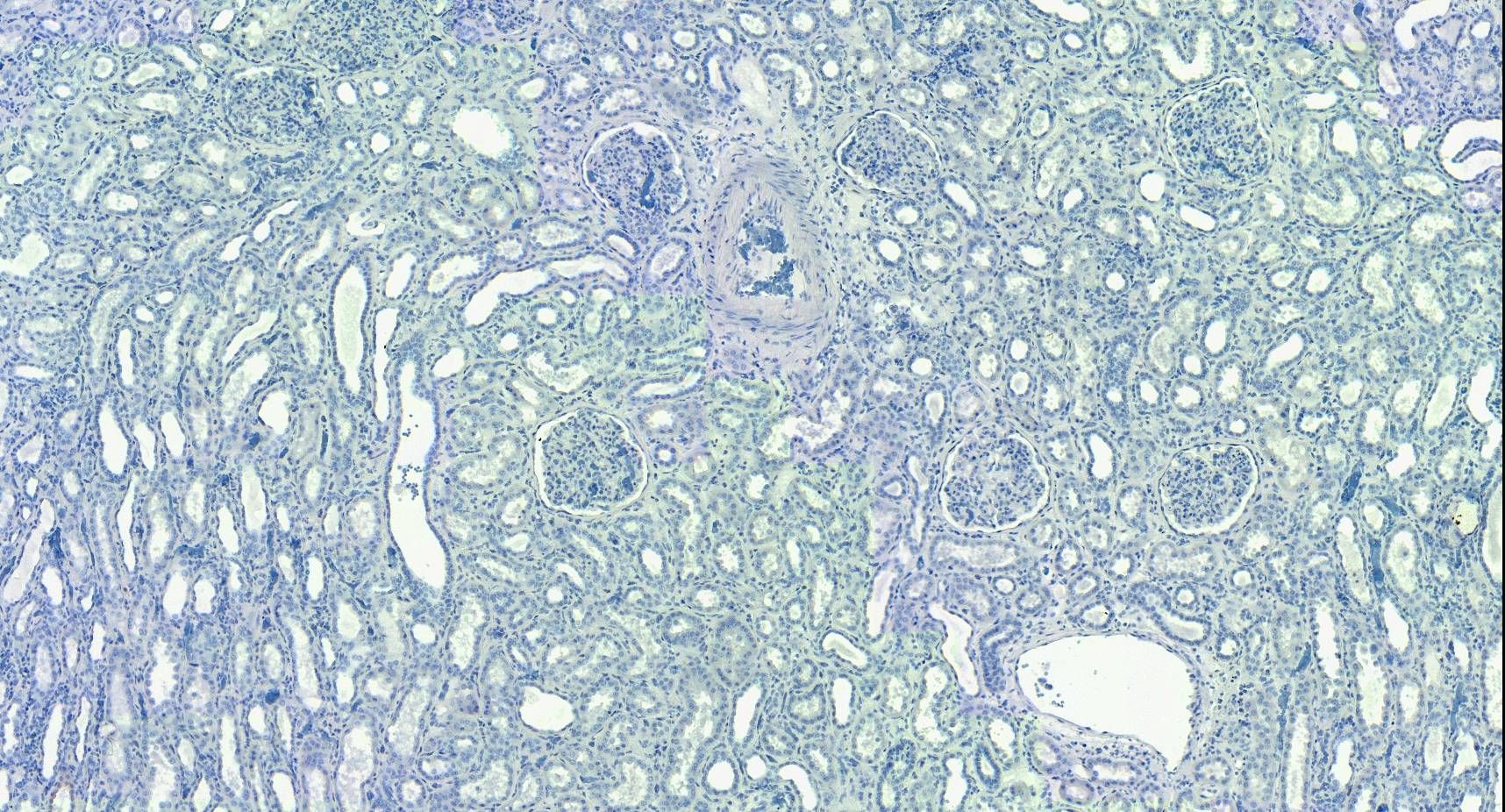 EWSR1 Antibody