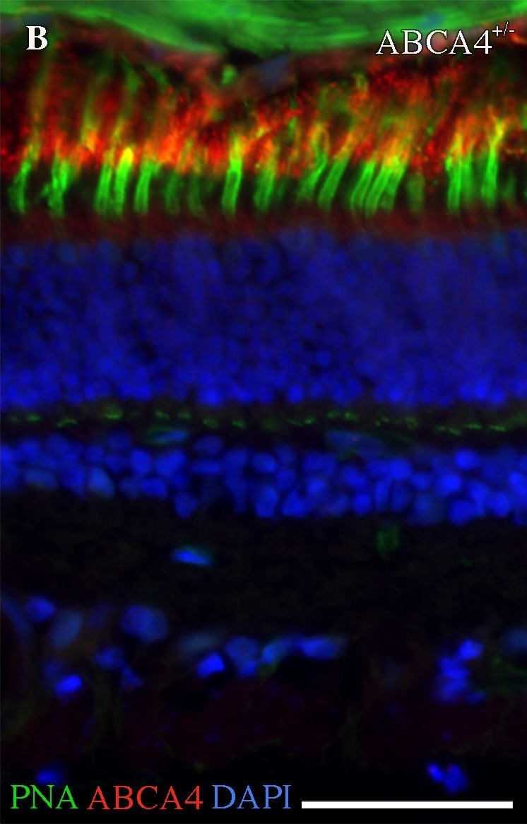 ABCA4 Antibody (3F4)