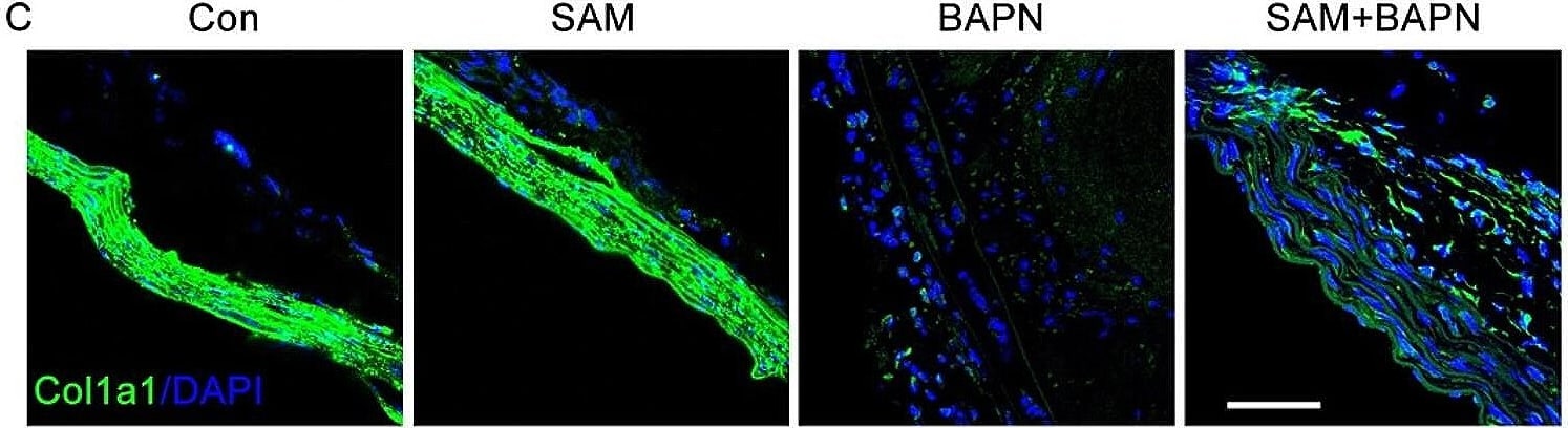 Collagen I alpha 1 Antibody - Azide and BSA Free