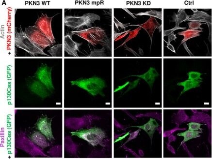 PKN3 Antibody