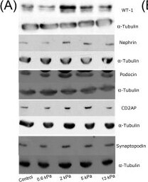 Nephrin Antibody (Y17-R)