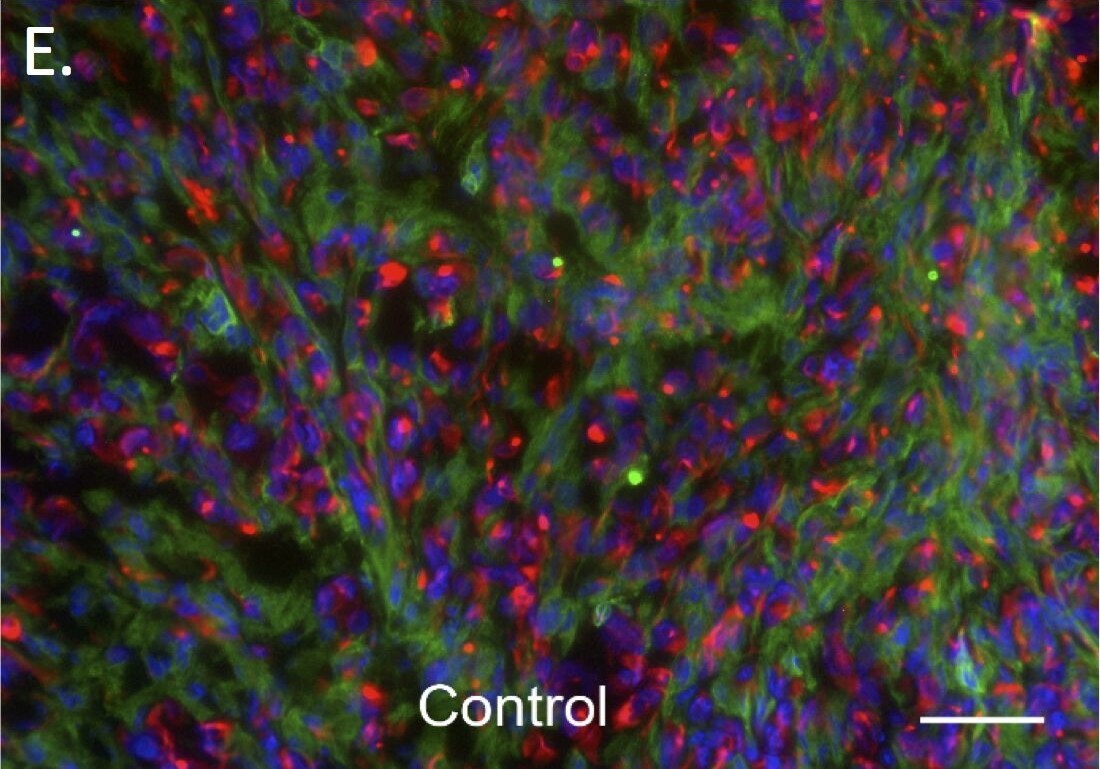 Cytokeratin 7 Antibody (R17-S)