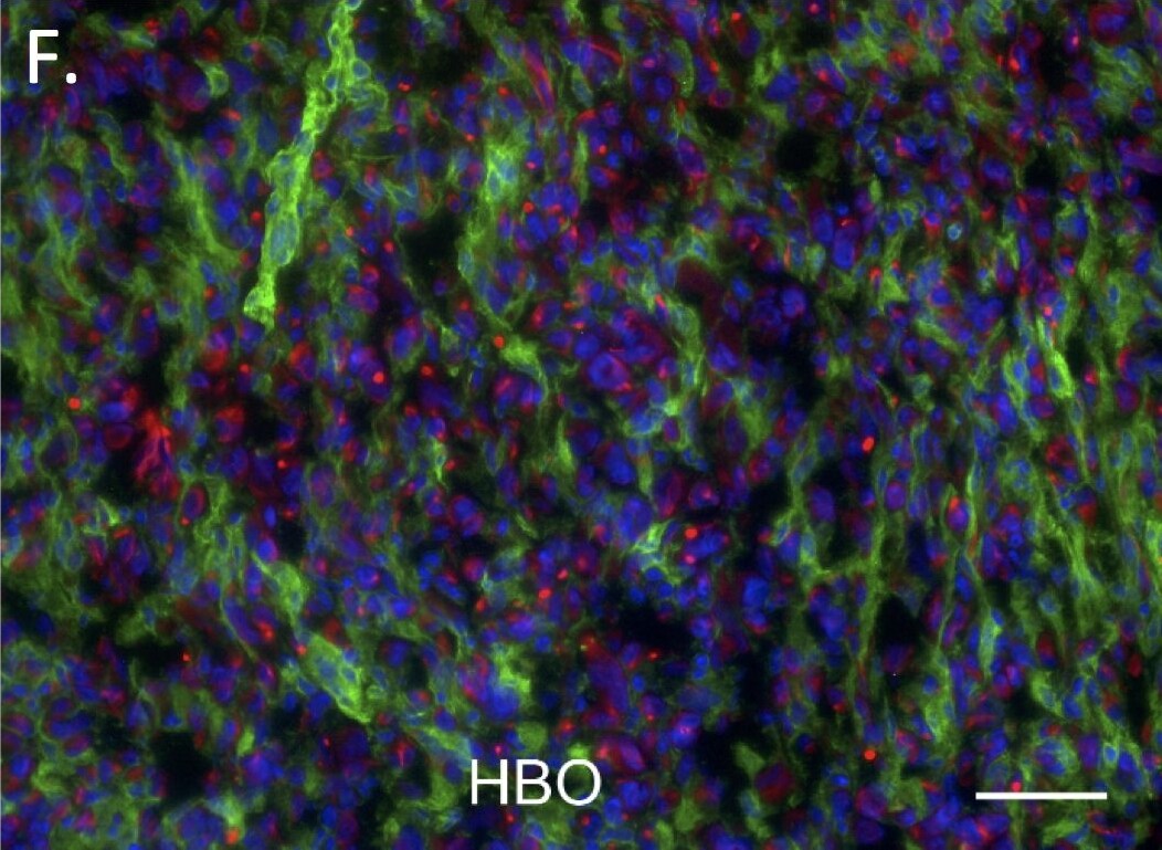 Cytokeratin 7 Antibody (R17-S)
