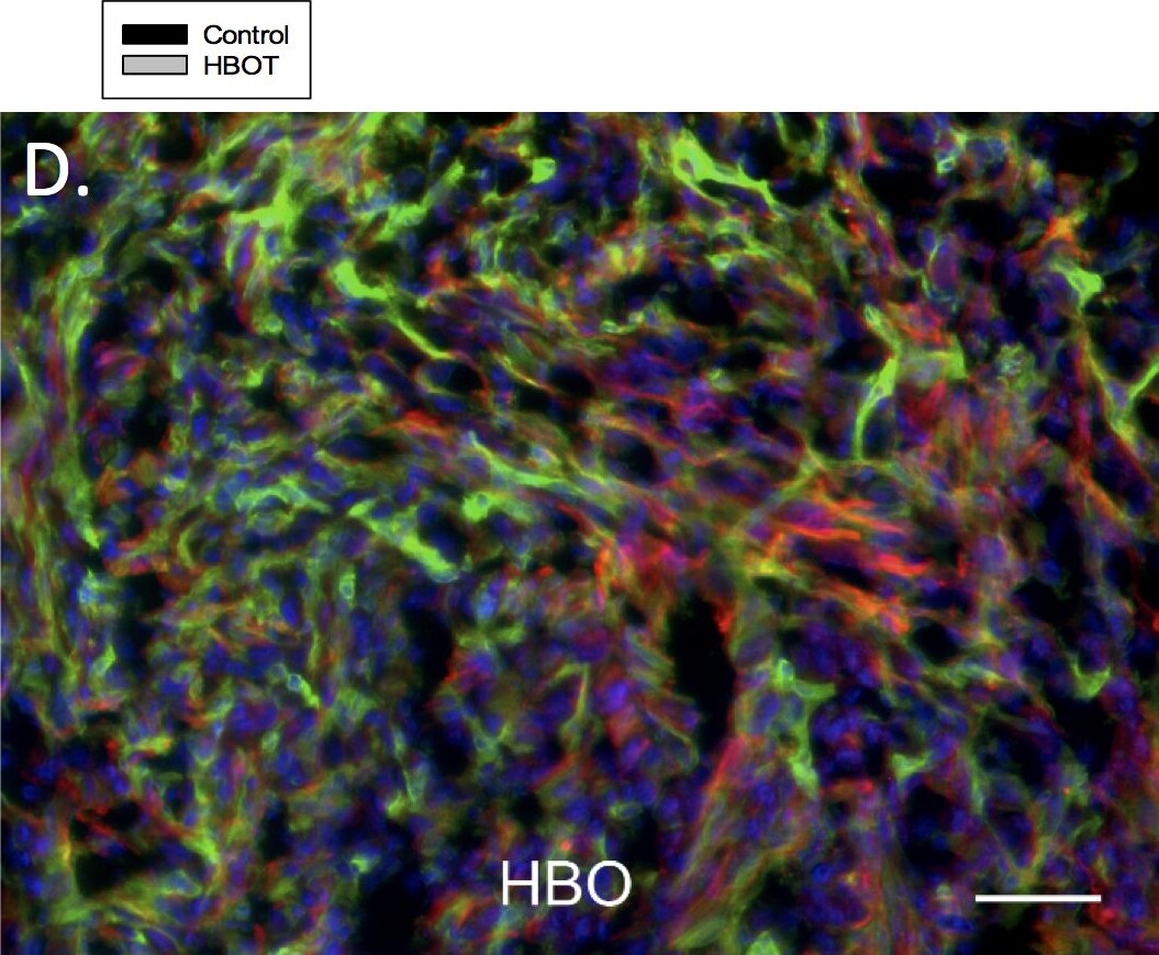 Cytokeratin 7 Antibody (R17-S)