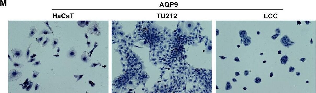 Aquaporin-9 Antibody