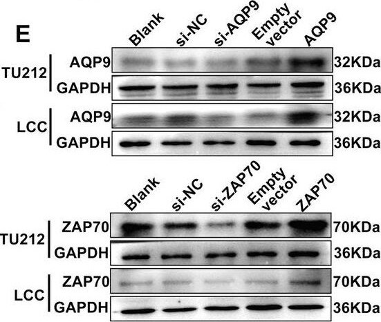 Aquaporin-9 Antibody