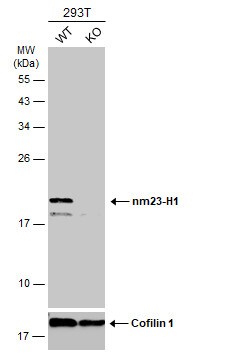 NM23-H1 Antibody
