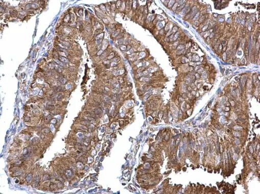 NM23-H1 Antibody
