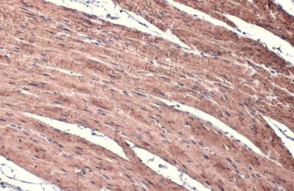 alpha-Smooth Muscle Actin Antibody