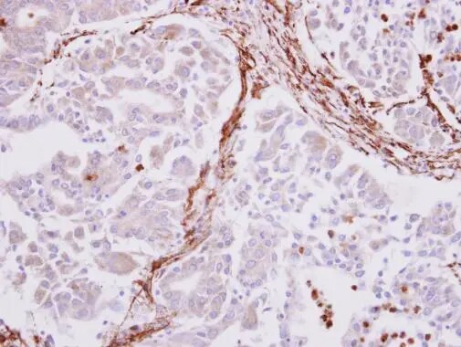 alpha-Smooth Muscle Actin Antibody