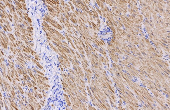 alpha-Smooth Muscle Actin Antibody