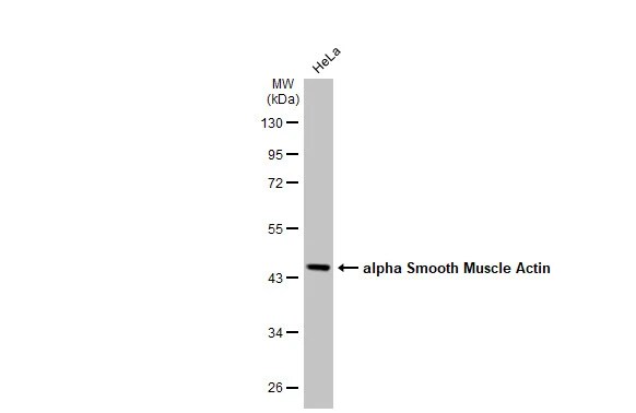 alpha-Smooth Muscle Actin Antibody