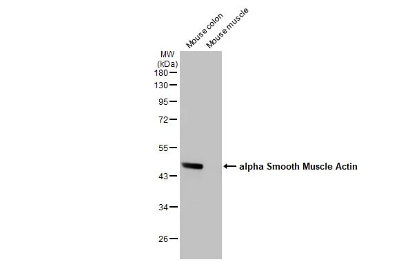 alpha-Smooth Muscle Actin Antibody