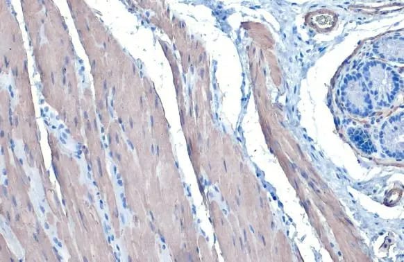 alpha-Smooth Muscle Actin Antibody