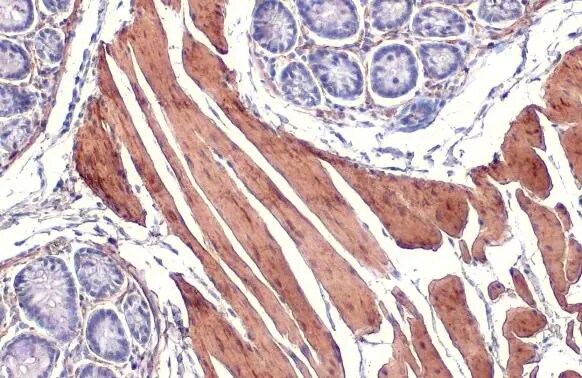 alpha-Smooth Muscle Actin Antibody