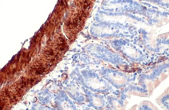 alpha-Smooth Muscle Actin Antibody