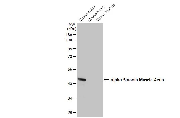 alpha-Smooth Muscle Actin Antibody