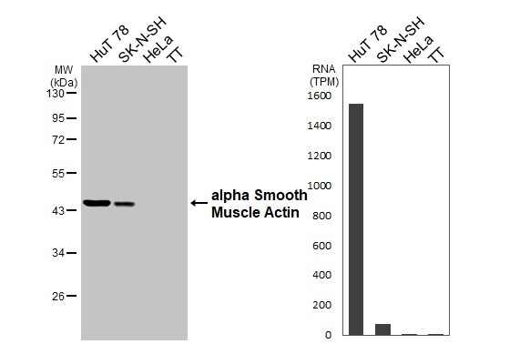 alpha-Smooth Muscle Actin Antibody - BSA Free