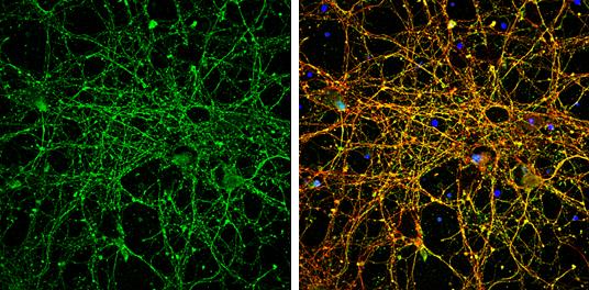 EEA1 Antibody - BSA Free