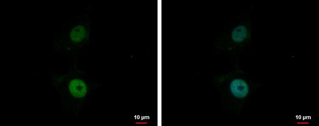 Bcl 7A Antibody - BSA Free