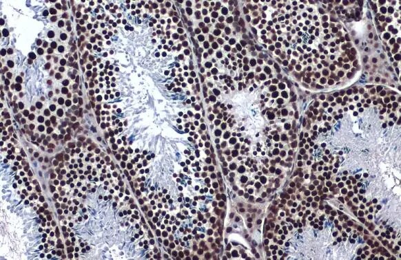 hnRNP K Antibody