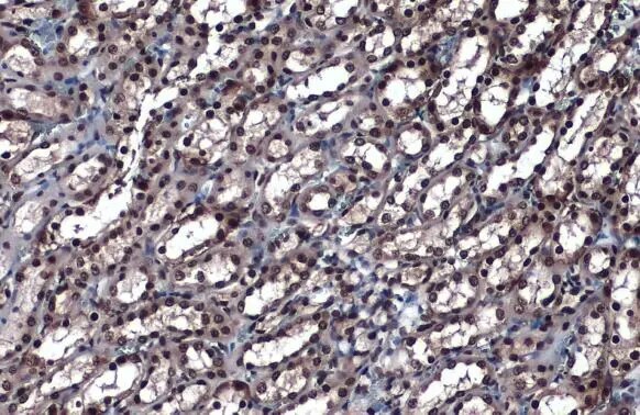 hnRNP K Antibody