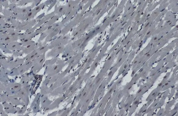 hnRNP K Antibody