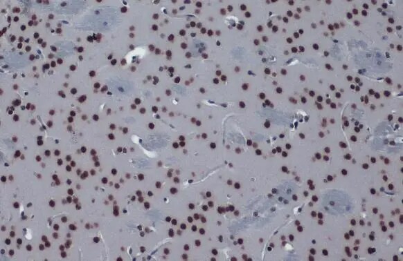 hnRNP K Antibody