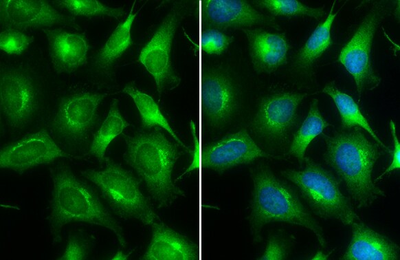 ARF5 Antibody