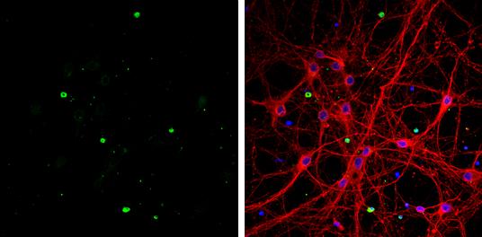 Olig1 Antibody - BSA Free