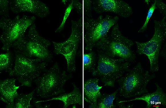 VPS35 Antibody
