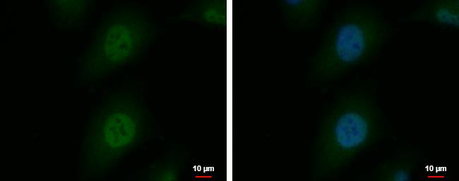 SNURPORTIN1 Antibody - BSA Free