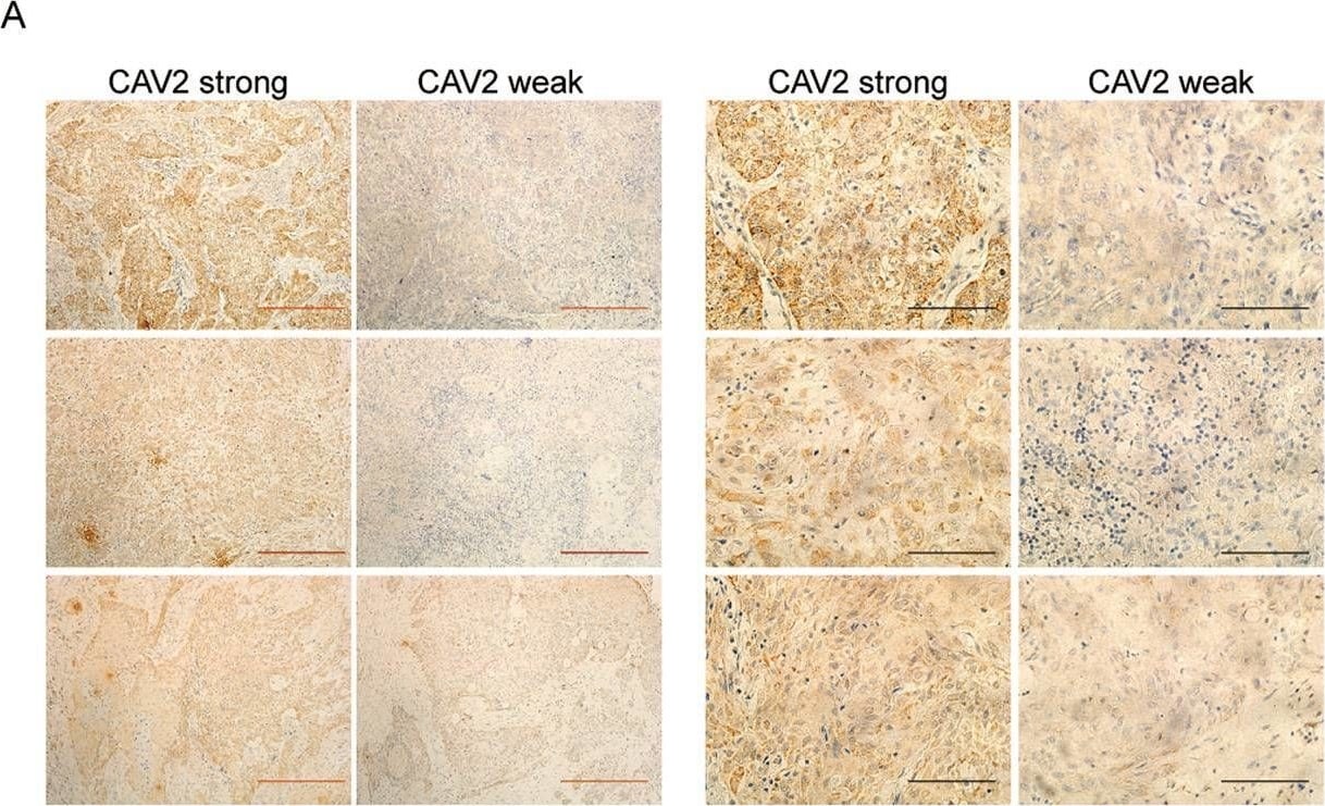 Caveolin-2 Antibody - BSA Free