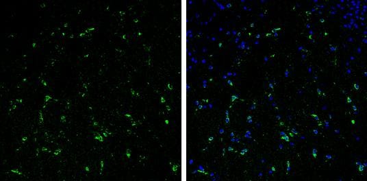 Stathmin 1 Antibody - BSA Free