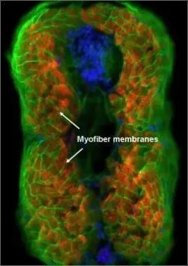 eRF1 Antibody